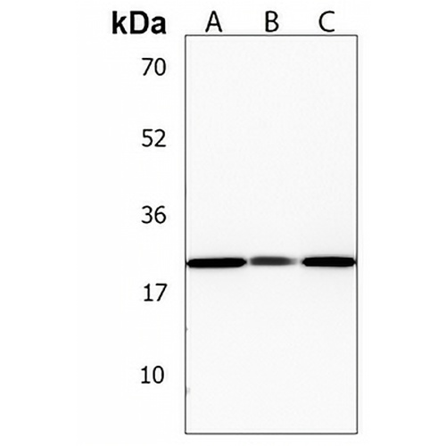 PNOC Rabbit Polyclonal Antibody