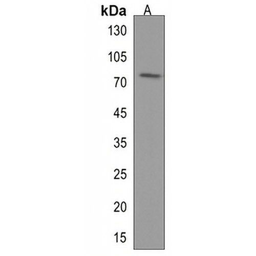DDX17 Rabbit Polyclonal Antibody