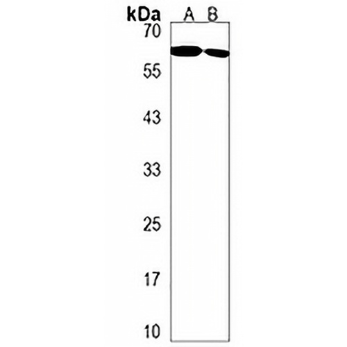 ENTPD2 Rabbit Polyclonal Antibody