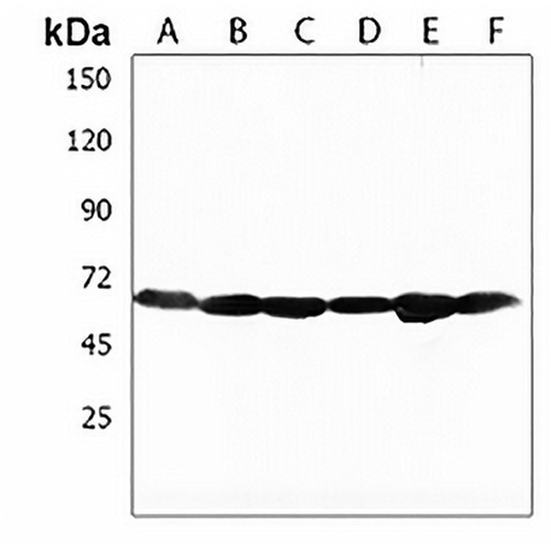 DLL3 Rabbit Polyclonal Antibody