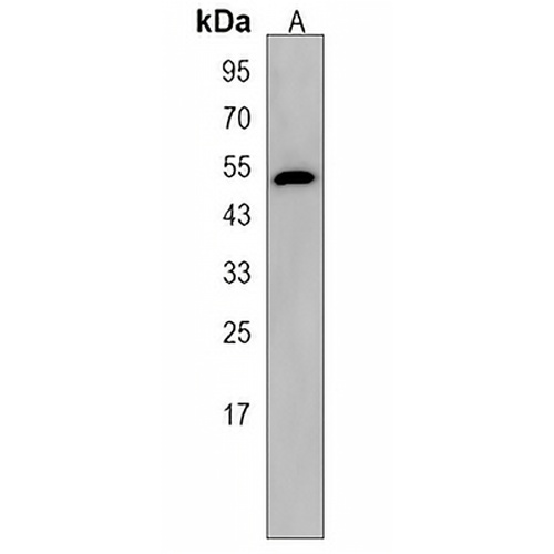 EYA4 Rabbit Polyclonal Antibody