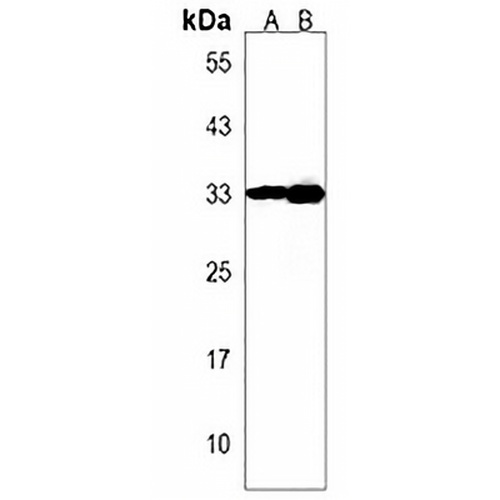 IMP4 Rabbit Polyclonal Antibody