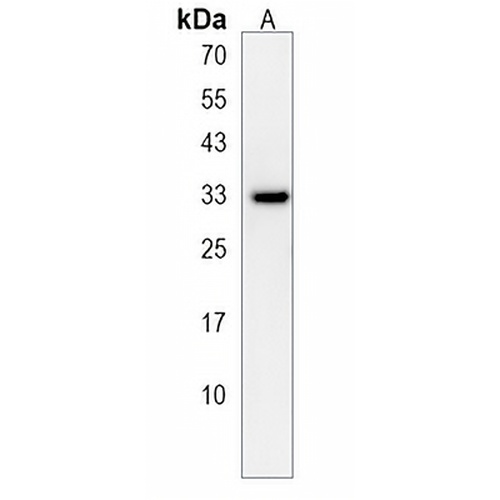 TMEM150A Rabbit Polyclonal Antibody