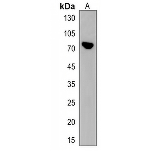 PLCZ1 Rabbit Polyclonal Antibody