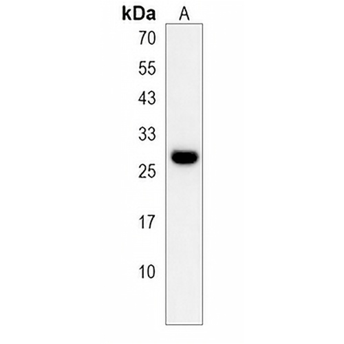 YIPF5 Rabbit Polyclonal Antibody