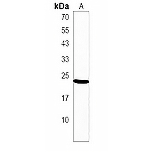 TIFA Rabbit Polyclonal Antibody