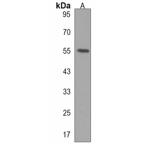 CENPI Rabbit Polyclonal Antibody