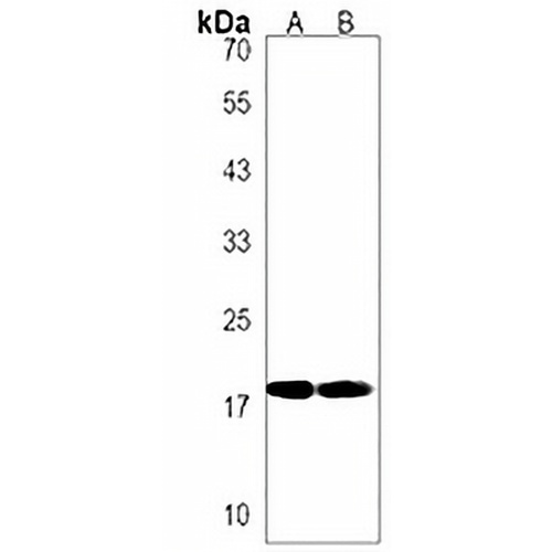 RPS11 Rabbit Polyclonal Antibody