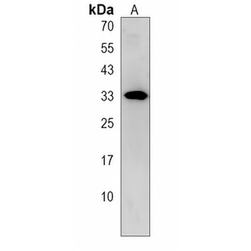 ECHDC1 Rabbit Polyclonal Antibody