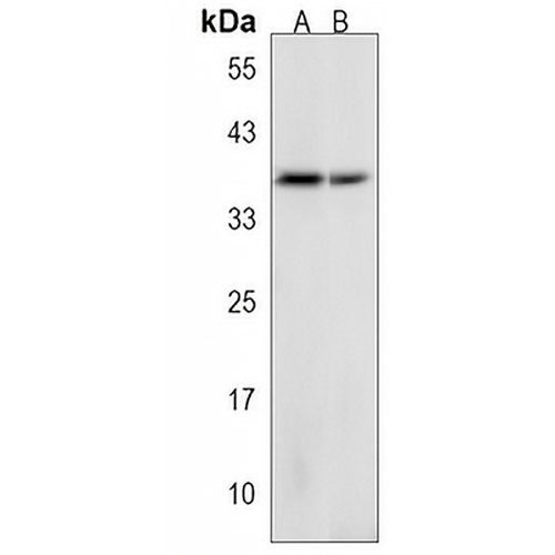 GSPT2 Rabbit Polyclonal Antibody