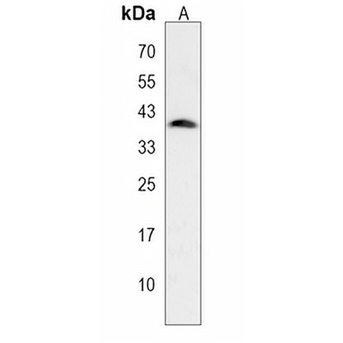 ADPRHL2 Rabbit Polyclonal Antibody