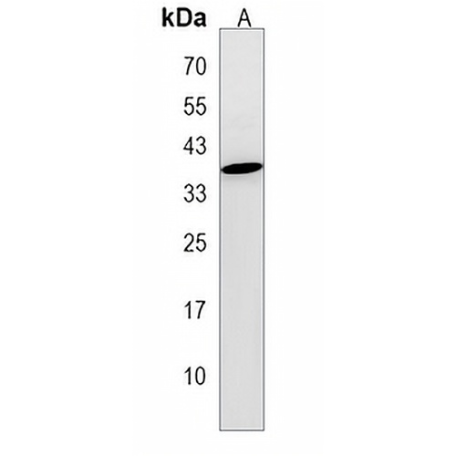 CLDND1 Rabbit Polyclonal Antibody