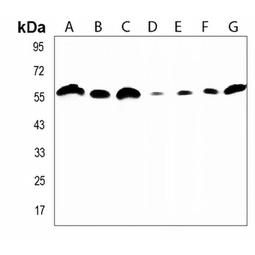 Artemis Rabbit Polyclonal Antibody