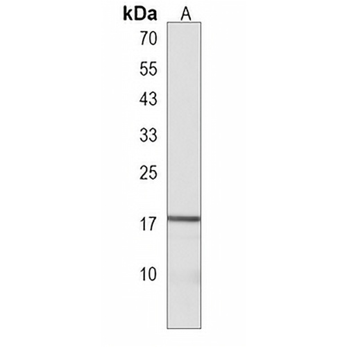 LYPD1 Rabbit Polyclonal Antibody