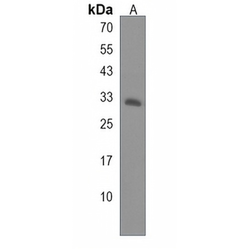 HSD17B11 Rabbit Polyclonal Antibody