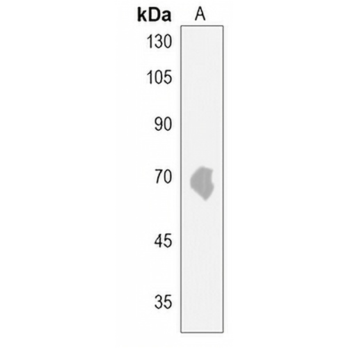 ACSBG2 Rabbit Polyclonal Antibody