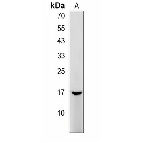 TYROBP Rabbit Polyclonal Antibody