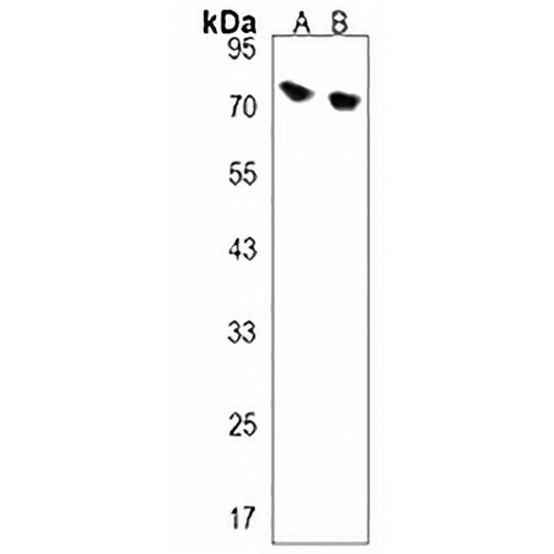 DCP1B Rabbit Polyclonal Antibody