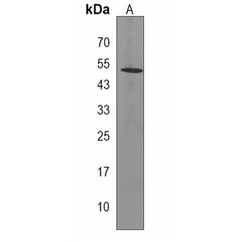 SDPR Rabbit Polyclonal Antibody