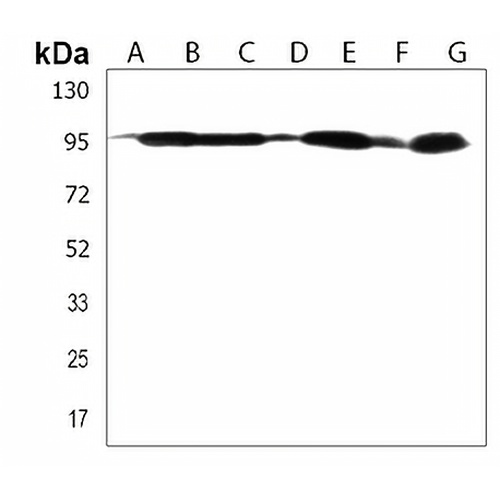 DNAJC6 Rabbit Polyclonal Antibody