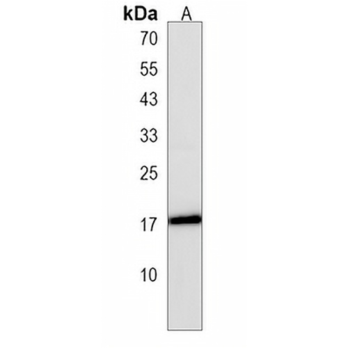 IMMP2L Rabbit Polyclonal Antibody