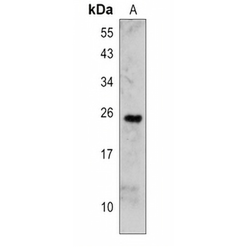 OMP Rabbit Polyclonal Antibody