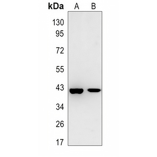 G6PC1 Rabbit Polyclonal Antibody