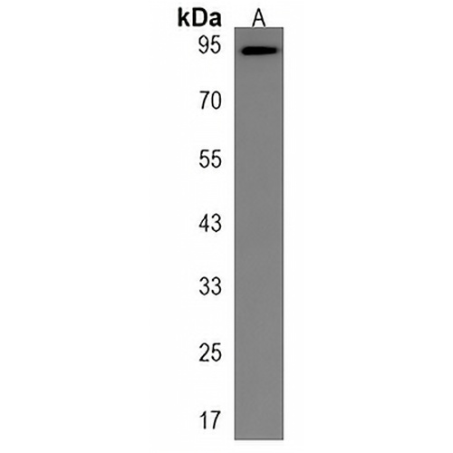 CTAGE6 Rabbit Polyclonal Antibody