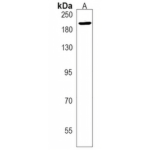 XRN1 Rabbit Polyclonal Antibody
