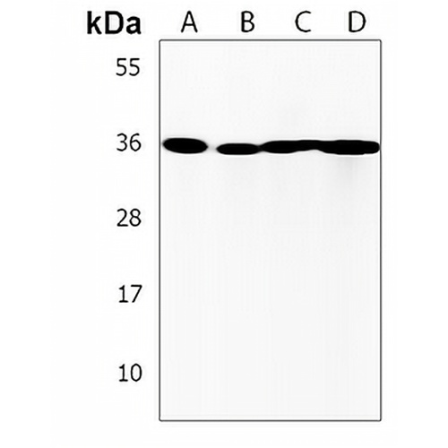 AKR7L Rabbit Polyclonal Antibody