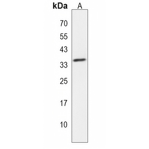AKR7L Rabbit Polyclonal Antibody