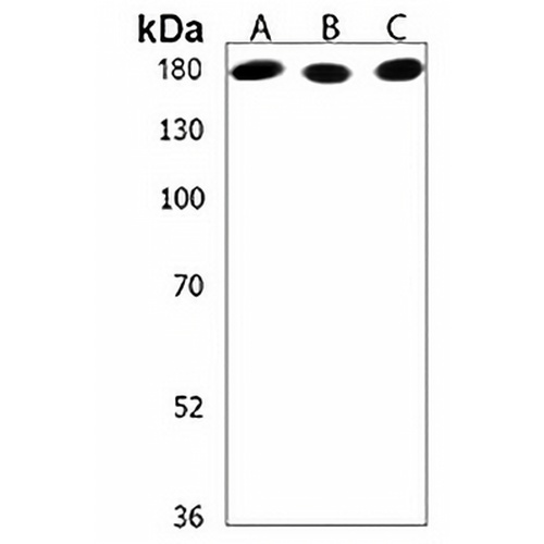 IQSEC2 Rabbit Polyclonal Antibody