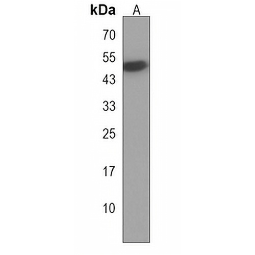 HYKK Rabbit Polyclonal Antibody