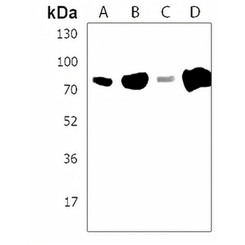 NEK10 Rabbit Polyclonal Antibody