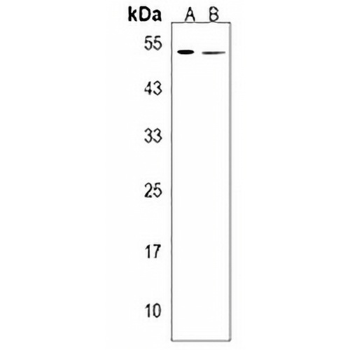 Carboxypeptidase A5 Rabbit Polyclonal Antibody