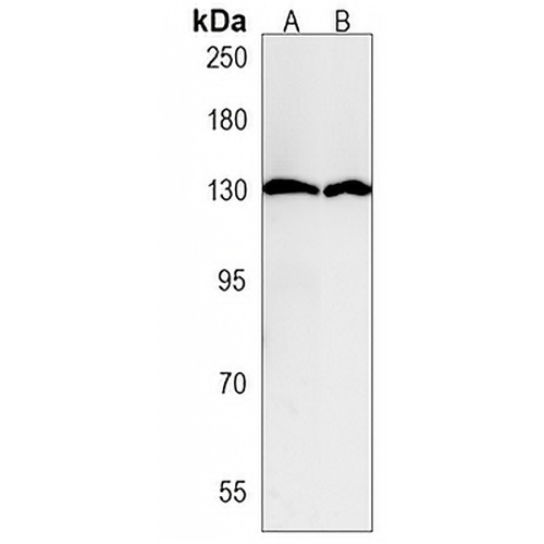 PPP6R1 Rabbit Polyclonal Antibody