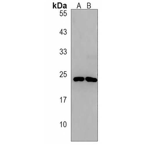 SEC11C Rabbit Polyclonal Antibody