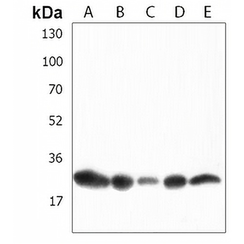 HNRNPA1L2 Rabbit Polyclonal Antibody