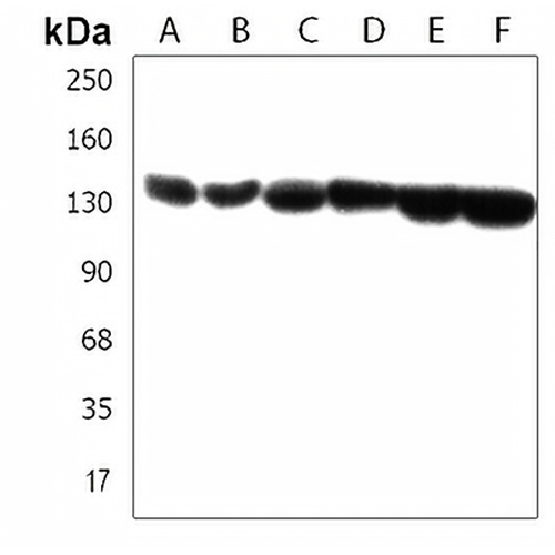 SRGAP2 Rabbit Polyclonal Antibody