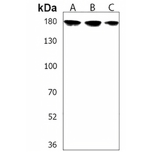 Calcium Sensing Receptor Rabbit Polyclonal Antibody