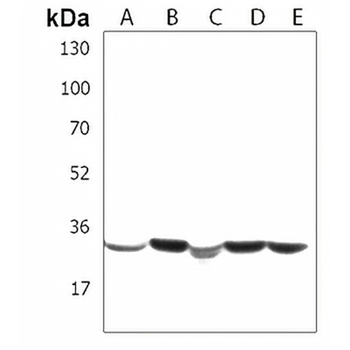SPPL2B Rabbit Polyclonal Antibody