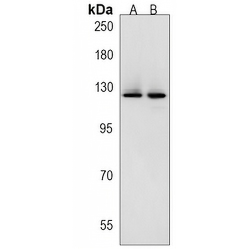 SRGAP3 Rabbit Polyclonal Antibody