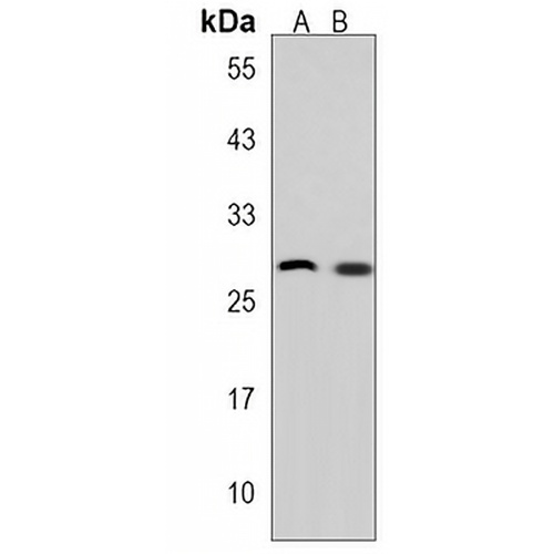 CELA2B Rabbit Polyclonal Antibody