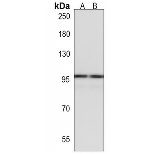 Adenylate Cyclase 5 Rabbit Polyclonal Antibody