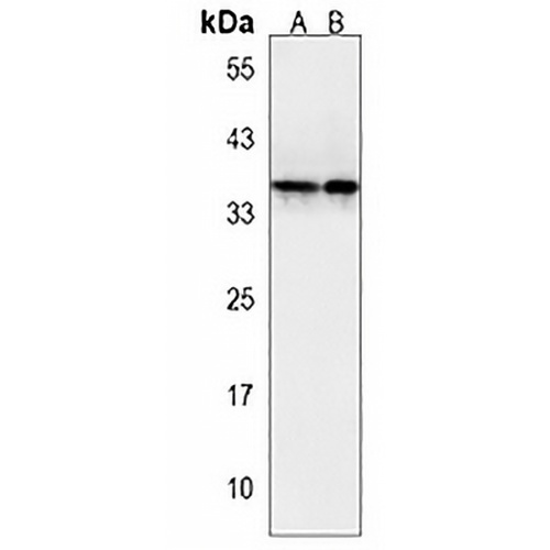 OR2T7 Rabbit Polyclonal Antibody