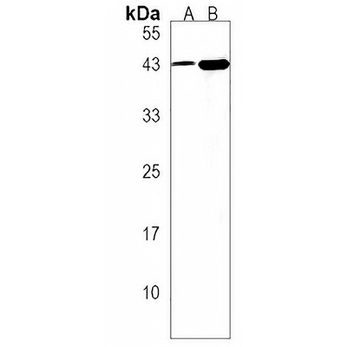 5-HT1E Rabbit Polyclonal Antibody
