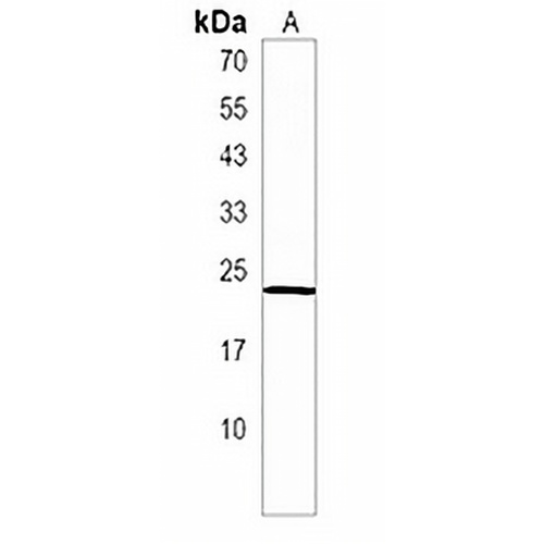 NACA2 Rabbit Polyclonal Antibody