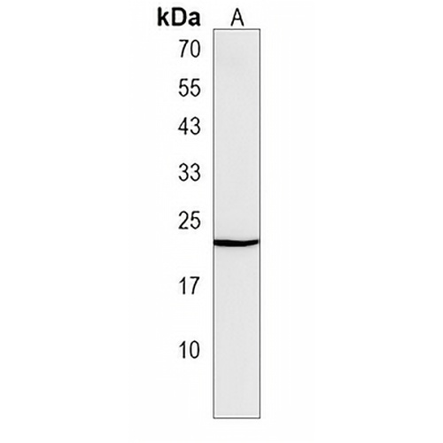 ROPN1 Rabbit Polyclonal Antibody
