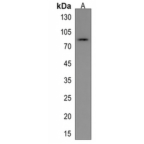 ADAM21 Rabbit Polyclonal Antibody