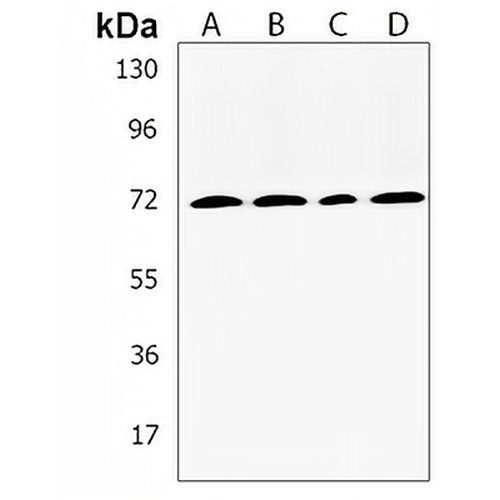 TMEM16K Rabbit Polyclonal Antibody